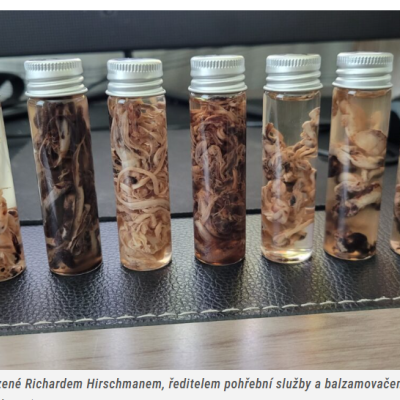 Patoložka Ute Krügerová, spoluautorka knihy o 57 případech úmrtí po očkování proti covidu-19, navštívila Prahu